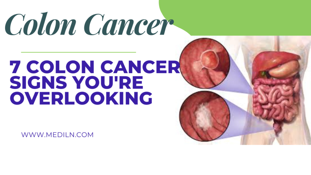7 Colon Cancer Signs You're Overlooking